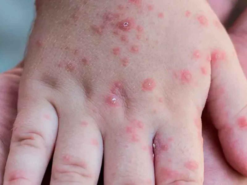 nac4141222